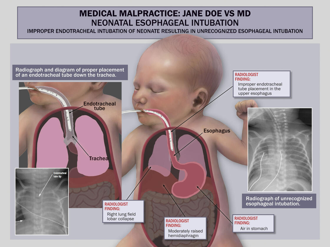 Medical Malpractice | Digital, 2021